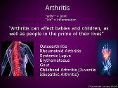 Rheumatoid Arthritis Osteoarthritis and Systemic Lupus Erythematosus