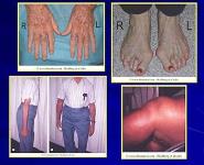 Rheumatology 101 PowerPoint Presentation Notes