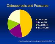 Osteoporosis Bad to the Bone PowerPoint Presentation