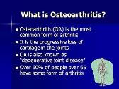 Medications for Osteoarthritis - Relieving the Pain
