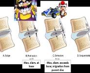 Chronic Low Back Pain & Interventional Spine Procedures PowerPoint Presentation Notes