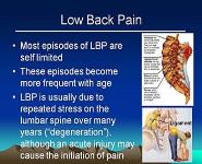 Lumbar disc disease PowerPoint Presentation