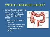 Overview of Colorectal Cancer