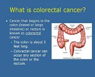 Overview of Colorectal Cancer PowerPoint Presentation Notes