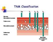 Gastrointestinal Cancer PowerPoint Presentation Notes