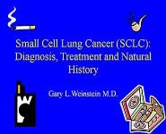Small Cell Lung Cancer (SCLC): Diagnosis Treatment and Natural History PowerPoint Presentation