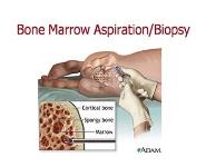 Lymphoma PowerPoint Presentation
