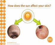 Skin Cancer - You can prevent it! PowerPoint Presentation