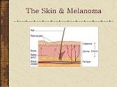 Skin Cancer: What You Should Know