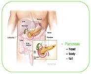 Pancreatic Carcinoma PowerPoint Presentation