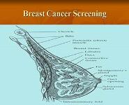 Screening for Breast Cervical Prostate and Lung Cancer PowerPoint Presentation Notes