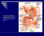 Prostate Cancer PowerPoint Presentation Notes
