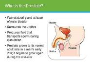 Understand Prostate Health PowerPoint Presentation Notes
