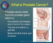 Prostate Cancer: Education and Outreach PowerPoint Presentation