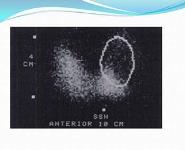 Approach to a Case of Thyroid Nodule PowerPoint Presentation Notes