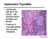 Thyroid Pathology PowerPoint Presentation