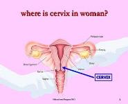 CERVICAL CANCER and ITS PREVENTION PowerPoint Presentation Notes