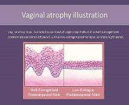 MENOPAUSE PowerPoint Presentation Notes