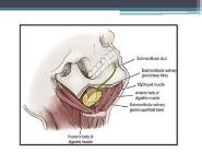 Submandibular gland: Surgical Anatomy Tumors Surgery PowerPoint Presentation Notes