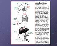 Thyroid Disease And Osteoporosis PowerPoint Presentation Notes