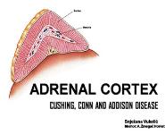 Adrenal Cortex - Cushing Conn and Addison Disease PowerPoint Presentation