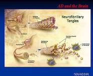 Imaging in Dementia: Options for Clinical Practice PowerPoint Presentation