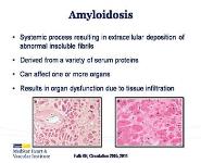Overview of Cardiac Amyloidosis PowerPoint Presentation