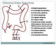 Colorectal Cancer Surgery PowerPoint Presentation