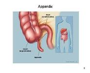 Appendix and Appendicitis PowerPoint Presentation Notes