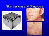 Skin Lesions and Diagnosis
