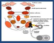 Central Neural Auditory Prosthesis PowerPoint Presentation