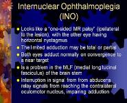 A and V Patterns and Other Types of Strabismus PowerPoint Presentation Notes