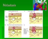 Cancer and the Immune System PowerPoint Presentation