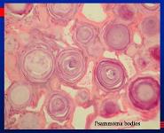 Some Bodies in the Brain PowerPoint Presentation Notes