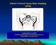 Diagnosis and Treatment of Pituitary Tumors PowerPoint Presentation Notes