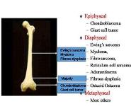 Orthopaedic Pathological Specimen and Histology PowerPoint Presentation Notes
