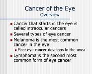 Cancers of the Eye PowerPoint Presentation Notes
