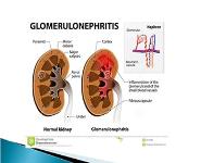 Urinary System Bolesti mokracnog sustava PowerPoint Presentation Notes