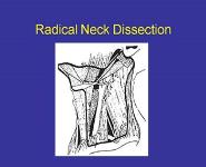 Surgical Management of the Neck in Head and Neck Cancer PowerPoint Presentation Notes