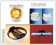 Rao PowerPoint Presentation