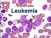 Leukemia