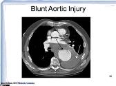 Acute Aortic Emergencies