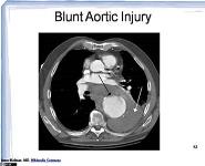 Acute Aortic Emergencies PowerPoint Presentation