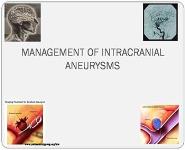 Management of Intracranial Aneurysms PowerPoint Presentation
