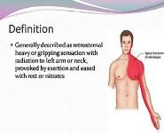 Angina Pectoris PowerPoint Presentation Notes