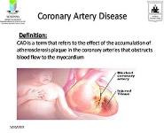 Coronary Artery Disease PowerPoint Presentation