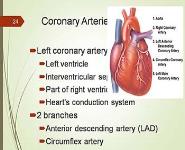 Angina Acute MI and Acute Stroke PowerPoint Presentation