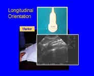Focused Emergency Ultrasound: Evaluation of the Abdominal Aorta PowerPoint Presentation Notes