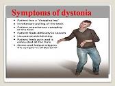 Dystonia