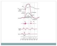 PULSE PowerPoint Presentation Notes